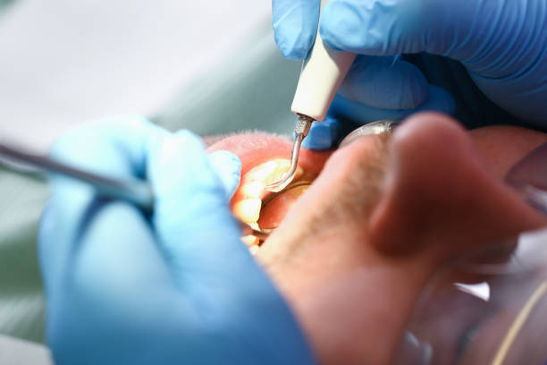 Best Emergency Dental Services for Seniors in Grosse Pointe Farms, MI